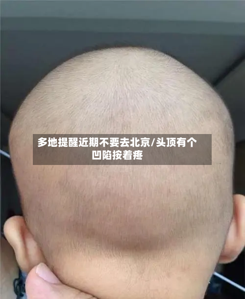 多地提醒近期不要去北京/头顶有个凹陷按着疼-第2张图片