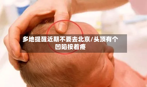多地提醒近期不要去北京/头顶有个凹陷按着疼-第1张图片