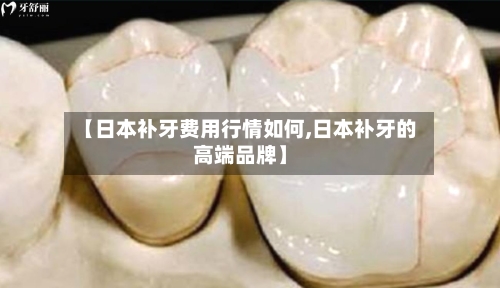 【日本补牙费用行情如何,日本补牙的高端品牌】-第2张图片