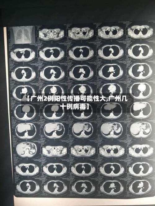 【广州2例阳性传播可能性大,广州几十例病毒】-第2张图片