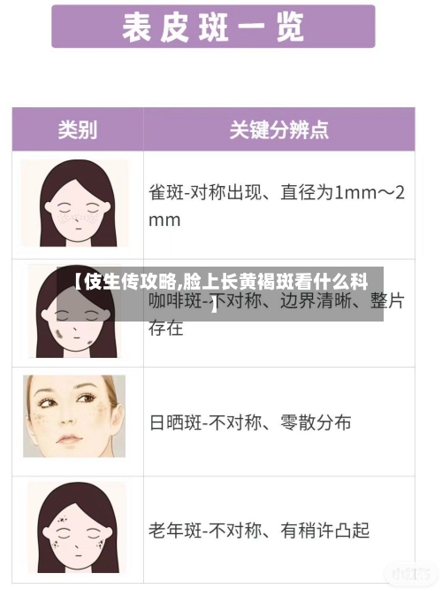 【伎生传攻略,脸上长黄褐斑看什么科】
