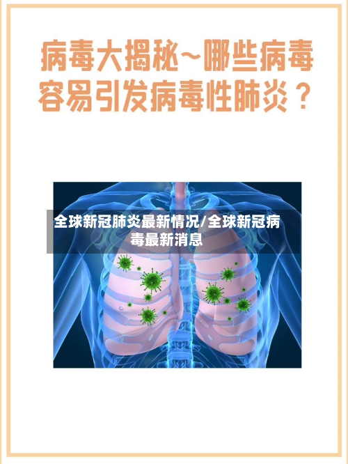 全球新冠肺炎最新情况/全球新冠病毒最新消息-第2张图片