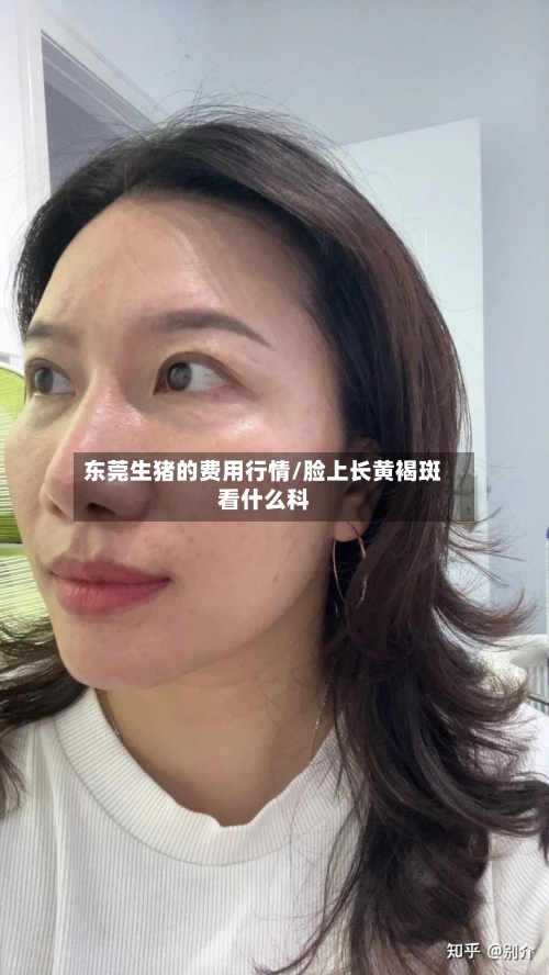 东莞生猪的费用行情/脸上长黄褐斑看什么科-第2张图片