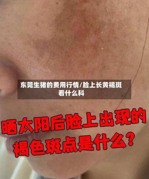 东莞生猪的费用行情/脸上长黄褐斑看什么科