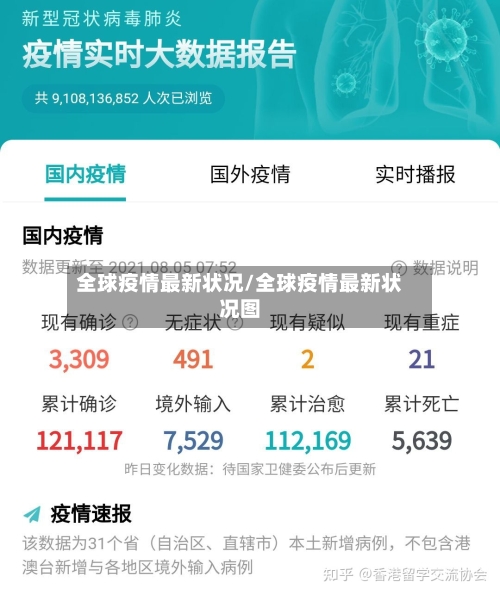 全球疫情最新状况/全球疫情最新状况图-第2张图片