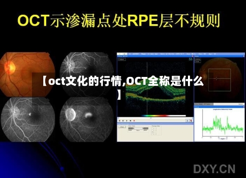 【oct文化的行情,OCT全称是什么】-第3张图片