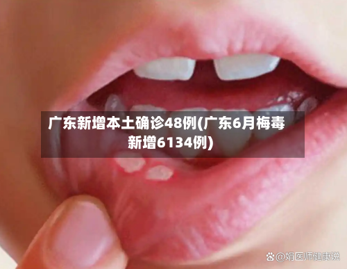 广东新增本土确诊48例(广东6月梅毒新增6134例)-第2张图片