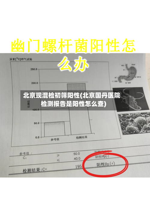 北京现混检初筛阳性(北京国丹医院检测报告是阳性怎么查)