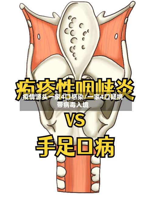 疫情源头一家4口感染/一家4口疑携带病毒入境