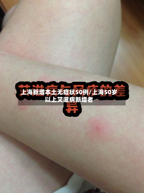 上海新增本土无症状50例/上海50岁以上艾滋病新增者