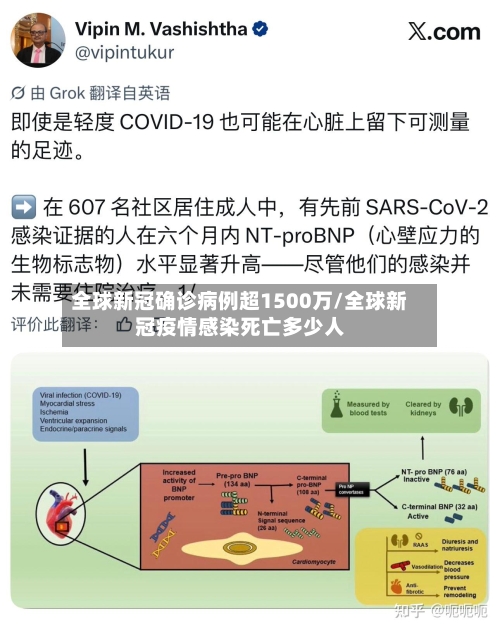全球新冠确诊病例超1500万/全球新冠疫情感染死亡多少人