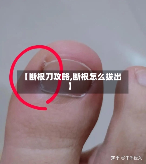 【断根刀攻略,断根怎么拔出】-第3张图片