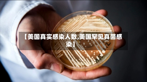 【美国真实感染人数,美国罕见真菌感染】-第3张图片