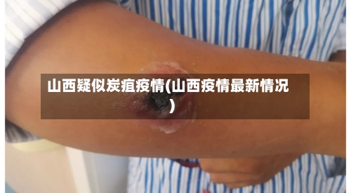 山西疑似炭疽疫情(山西疫情最新情况)